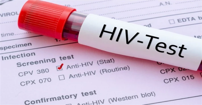 Çalışma Bakanlığı: HIV virüsü taşıyan bir kişiye çalışma izni verilmesi söz konusu değildir
